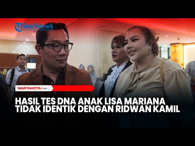 Hasil Tes DNA Anak Lisa Mariana Tidak Identik dengan Ridwan Kamil