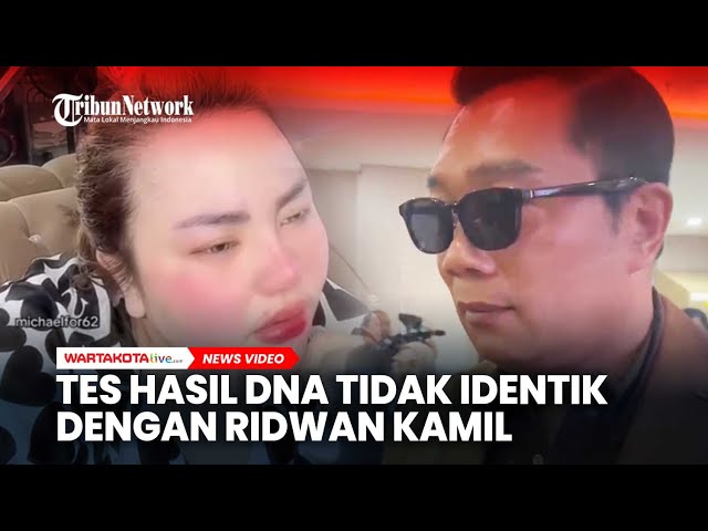Hasil Tes DNA Anak Tidak Identik dengan Ridwan Kamil