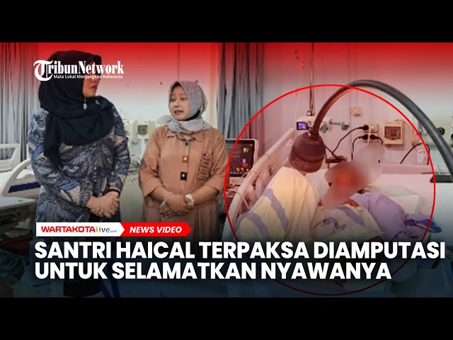Santri Haical Terpaksa Jalani Amputasi untuk Selamatkan Nyawanya