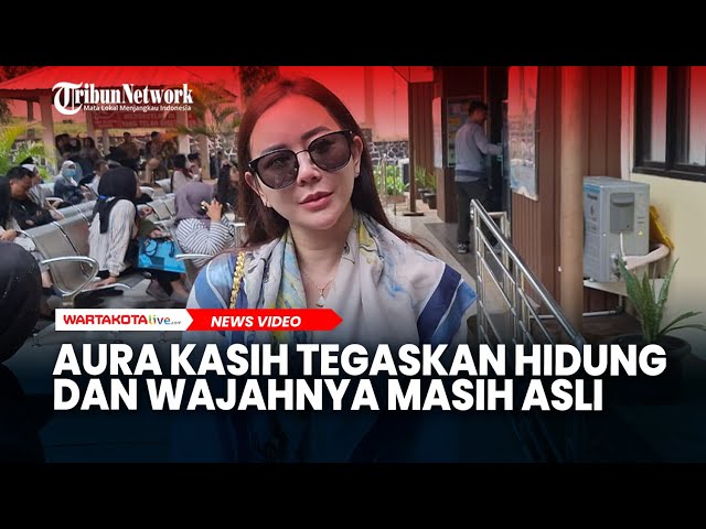 Aura Kasih Tegaskan Hidung dan Wajahnya Masih Asli, Bantah Operasi Plastik!